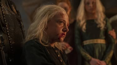 Aemond Targaryen sits with a bloody face and stitches in one eye.